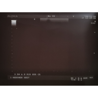 Aloka - UST-5045 P - Biopsy Probe - Transducer