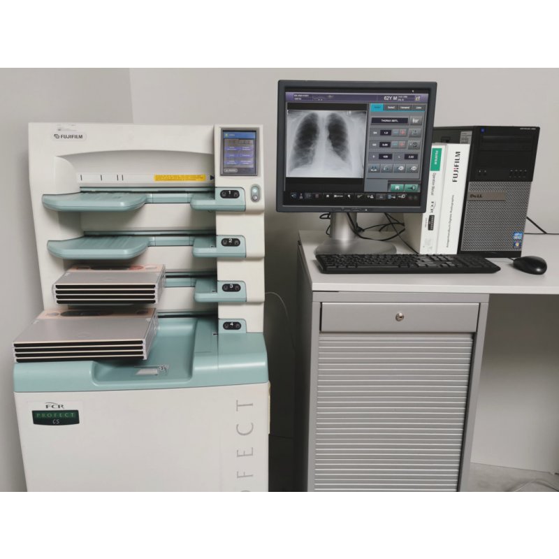 CR System - Fuji - FCR Profect CS - CR-IR 363 - incl. workstation + c