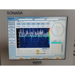 Transcranial Doppler - Viasys - SONARA