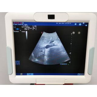 Ultrasound - Esaote - Mylab 60 + LA435 + LA522E + CA631