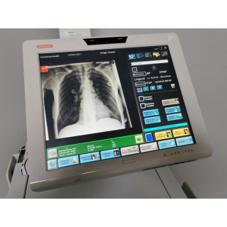 Portable x-ray - Siemens - Mobilett XP