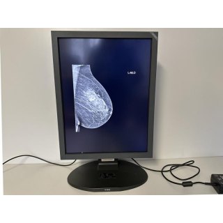 mammography monitor - TOTOKU - ME315L - MDL2105A
