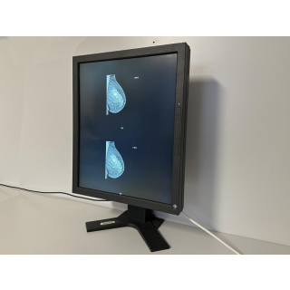 mammography monitor - Eizo - RadioForce G51