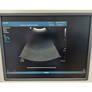 Ultrasound System with Convex Probe (C6-3) - Philips UltrasounUltraschallsystem mit Konvexschallkopf (C6-3)