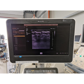 Linear Ultrasound Probe &ndash; Philips &ndash; L12-3 &ndash; Linear-Ultraschallsonde