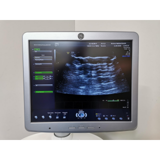 Ultrasound System - Philips - CX50 - Ultraschallger&auml;t