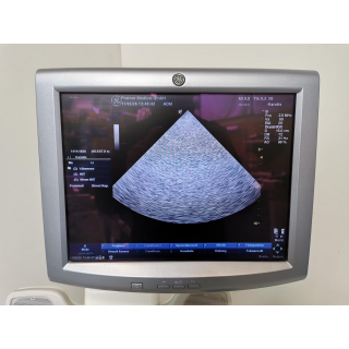 Ultrasound System &ndash; GE Healthcare &ndash; LOGIQ P5 &ndash; Ultraschallsystem