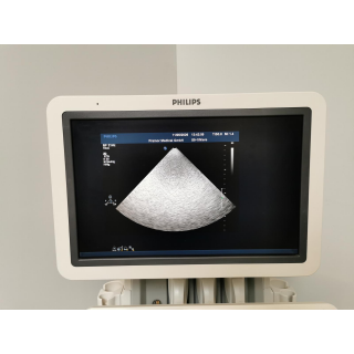 Ultrasound System &ndash; Philips &ndash; iE33 &ndash; Ultraschallsystem