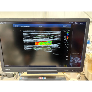 Linear Ultrasound Probe &ndash; Toshiba &ndash; PLT-1005BT &ndash; Lineare Ultraschallsonde