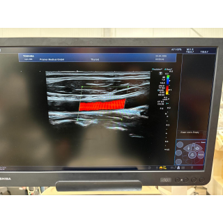 Linear Ultrasound Probe &ndash; Toshiba &ndash; PLT-1005BT &ndash; Lineare Ultraschallsonde