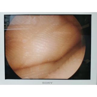 Laparoscopic Trocar Sleeve &ndash; Karl Storz &ndash; 27040 SL &ndash; Laparoskopische Trokarh&uuml;lse