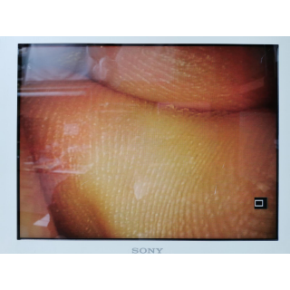 Rigid Video Endoscope &ndash; Olympus Medical &ndash; WA50120A &ndash; Starres Videoendoskop