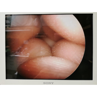Rigid Endoscope 0&deg; &ndash; Karl Storz &ndash; 10320 A &ndash; Starres Endoskop 0&deg;