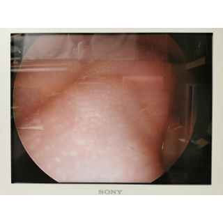 Rigid Endoscope 0&deg; &ndash; Endotec Medical Systems &ndash; 701382 &ndash; Starres Endoskop 0&deg;