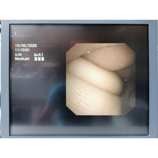 Video Bronchoscope &ndash; Olympus Medical &ndash; BF-3C160 &ndash; Video-Bronchoskop