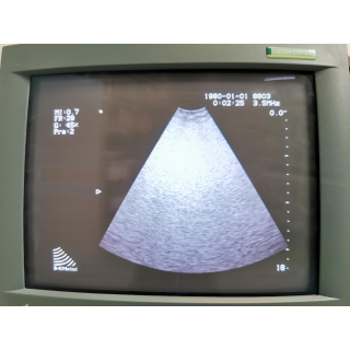 Ultrasound Scanner with Type 8803 Probe &ndash; B-K Medical &ndash; 2101 Falcon / Type 8803 Probe &ndash; Ultraschallsystem mit Type 8803 Sonde