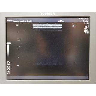 Toshiba Nemio MX SSA-590A Ultrasound System with 2 Probes &ndash; Ultraschallsystem mit 2 Sonden