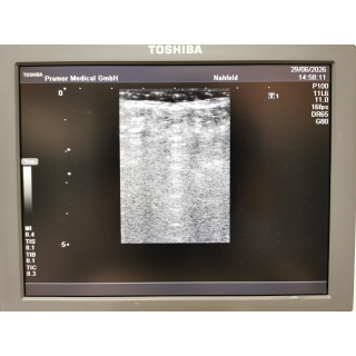 Toshiba Nemio MX SSA-590A Ultrasound System with 2 Probes &ndash; Ultraschallsystem mit 2 Sonden