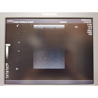 Toshiba Nemio MX SSA-590A Ultrasound System with 2 Probes &ndash; Ultraschallsystem mit 2 Sonden