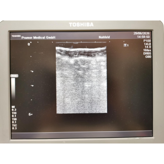Toshiba Nemio MX SSA-590A Ultrasound System with 2 Probes &ndash; Ultraschallsystem mit 2 Sonden