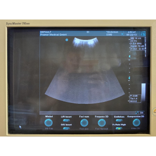 Convex Ultrasound Probe &ndash; GE Healthcare &ndash; C358 / 2259151 &ndash; Konvexe Ultraschallsonde