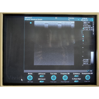Linear Ultrasound Probe &ndash; GE Healthcare &ndash; 7L / 2302648 &ndash; Lineare Ultraschallsonde