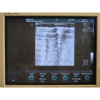 Linear Ultrasound Probe &ndash; GE Healthcare &ndash; 7L / 2302648 &ndash; Lineare Ultraschallsonde