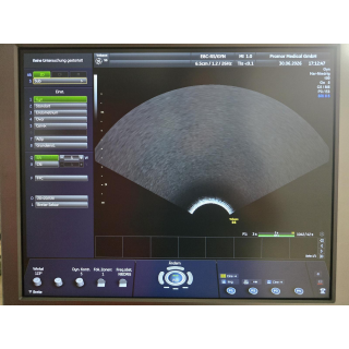 Endocavity Ultrasound Probe &ndash; GE Healthcare &ndash; E8C-RS / 5318734 &ndash; Endokavit&auml;re Ultraschallsonde