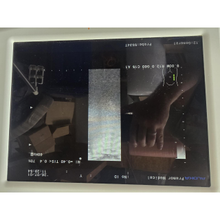 Ultrasound Probe &ndash; Hitachi Aloka Medical &ndash; UST-5534T-7.5 &ndash; Ultraschallsonde