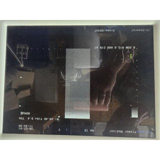 Ultrasound Probe &ndash; Hitachi Aloka Medical &ndash; UST-5534T-7.5 &ndash; Ultraschallsonde