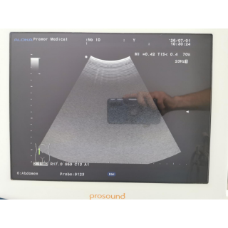 Ultrasound System with Probes &ndash; Aloka &ndash; ProSound &alpha;6 + IPF-1503 / Probes &ndash; Ultraschallsystem mit Sonden