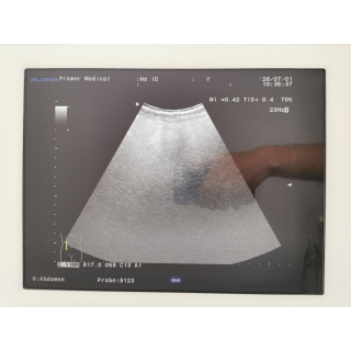 Ultrasound System with Probes &ndash; Aloka &ndash; ProSound &alpha;6 + IPF-1503 / Probes &ndash; Ultraschallsystem mit Sonden