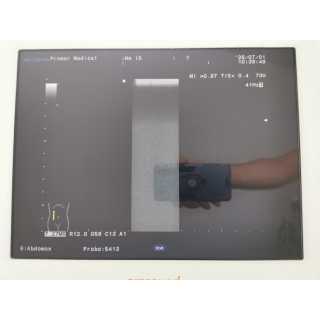 Ultrasound System with Probes &ndash; Aloka &ndash; ProSound &alpha;6 + IPF-1503 / Probes &ndash; Ultraschallsystem mit Sonden