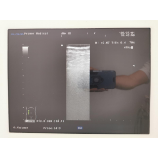Ultrasound System with Probes &ndash; Aloka &ndash; ProSound &alpha;6 + IPF-1503 / Probes &ndash; Ultraschallsystem mit Sonden