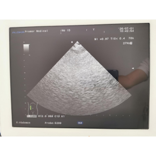 Ultrasound System with Probes &ndash; Aloka &ndash; ProSound &alpha;6 + IPF-1503 / Probes &ndash; Ultraschallsystem mit Sonden