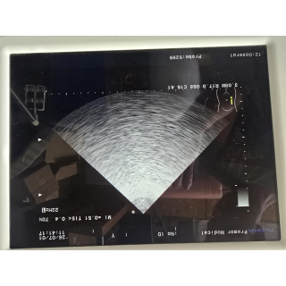 Ultrasound Probe &ndash; Aloka &ndash; UST-5299 &ndash; Ultraschallsonde