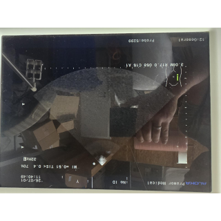 Ultrasound Probe &ndash; Aloka &ndash; UST-5299 &ndash; Ultraschallsonde