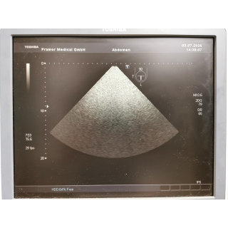 Transesophageal Ultrasound Probe &ndash; Toshiba Medical Systems &ndash; PET-510MA &ndash; TEE-Ultraschallsonde