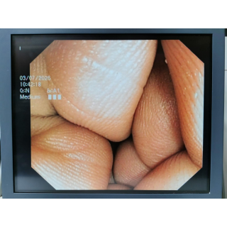 Colonoscope &ndash; Olympus Medical &ndash; CF-Q165L &ndash; Koloskop