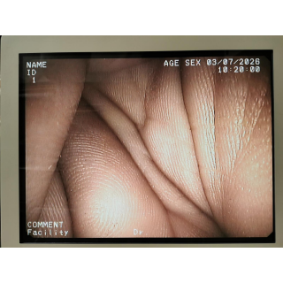 Duodenoscope &ndash; Pentax Medical &ndash; ED-3430TK &ndash; Duodenoskop