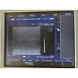 Ultrasound Probe &ndash; Hitachi &ndash; EUP-L73S &ndash; Ultraschallsonde