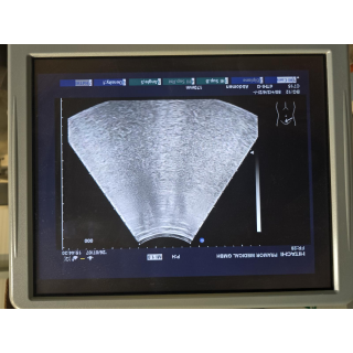 Ultrasound Probe &ndash; Hitachi &ndash; EUP-C715 &ndash; Ultraschallsonde