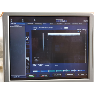 Ultrasound Probe &ndash; Hitachi &ndash; EUP-L54M &ndash; Ultraschallsonde