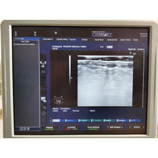 Ultrasound Probe &ndash; Hitachi &ndash; EUP-L54M &ndash; Ultraschallsonde