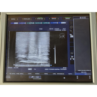 Ultrasound Probe &ndash; Hitachi &ndash; EUP-L73S &ndash; Ultraschallsonde