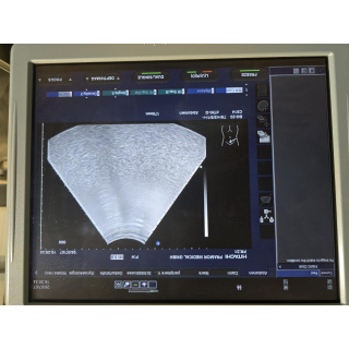 Ultrasound Probe &ndash; Hitachi &ndash; EUP-C514 &ndash; Ultraschallsonde