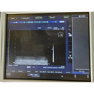 Ultrasound Probe &ndash; Hitachi &ndash; EUP-L52 &ndash; Ultraschallsonde