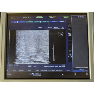 Ultrasound Probe &ndash; Hitachi &ndash; EUP-L52 &ndash; Ultraschallsonde