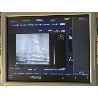 Ultrasound Probe &ndash; Hitachi &ndash; EUP-L54MA &ndash; Ultraschallsonde