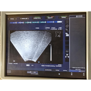 Convex Ultrasound Probe &ndash; Hitachi &ndash; EUP-B514 &ndash; Konvex-Ultraschallsonde